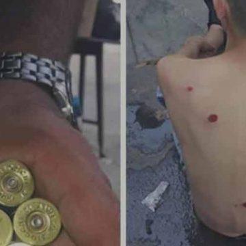 Hinchas de Chicago heridos