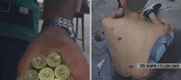 Hinchas de Chicago heridos