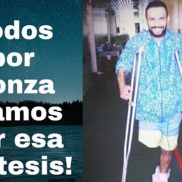 Mataderos: Necesita una prótesis millonaria y pide la ayuda de los vecinos