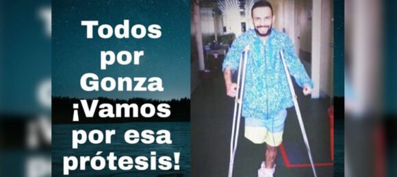 Mataderos: Necesita una prótesis millonaria y pide la ayuda de los vecinos